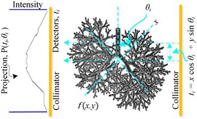 Simulated Annealing-Based Image Reconstruction for Patients With COVID-19 as a Model for Ultralow-Dose Computed Tomography